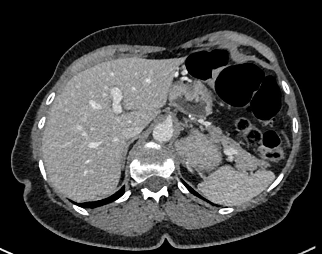 scanner paris 17 18 scanner abdominopelvien